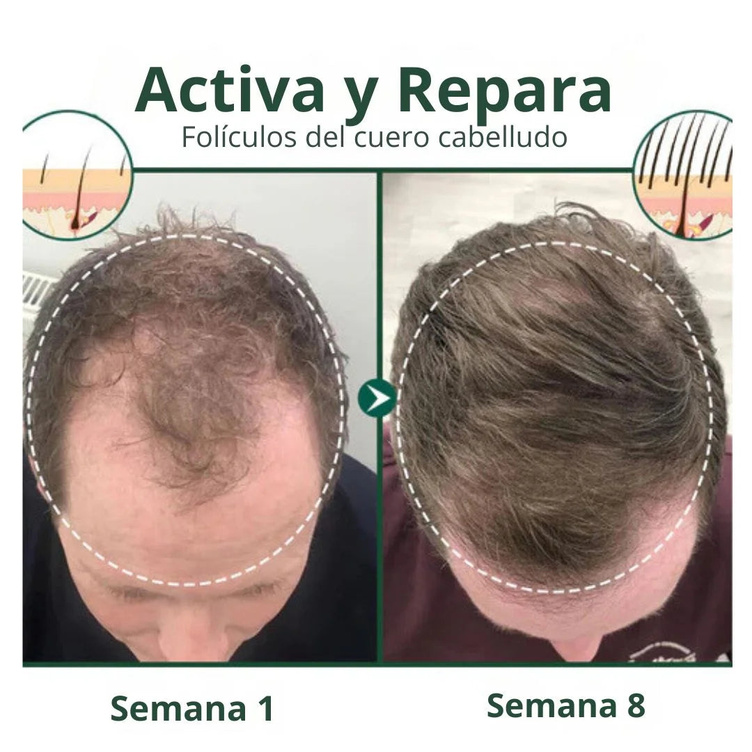 2X1🔥¡tonico crece pelo ultra 100% Batata y Romero.!!🔥☄️
